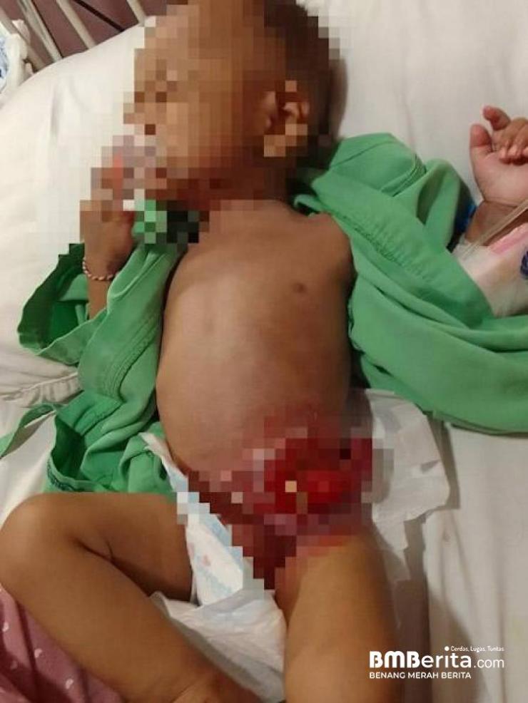 Paska Operasi Aidil di RS Swasta, Keluarga Terhutang 40 Jt, Kini Butuh Uluran Para Donatur